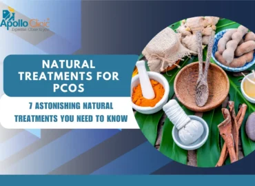 Natural treatments for PCOS