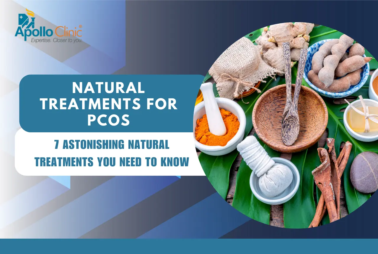 Natural treatments for PCOS