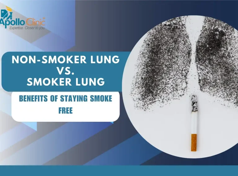 non-smoker lung vs smokers lung