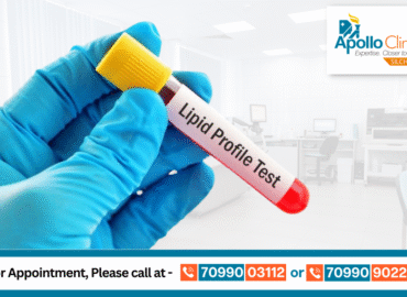 Lipid Profile Test