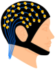 Electroencephalography (EEG)